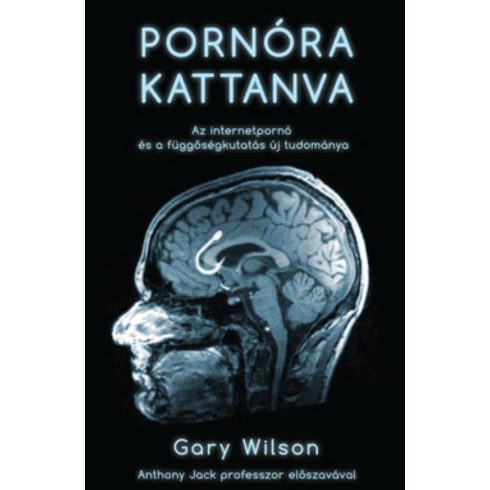 Gary Wilson: Pornóra kattanva /Az internetpornó és a függőségkutatás új tudománya