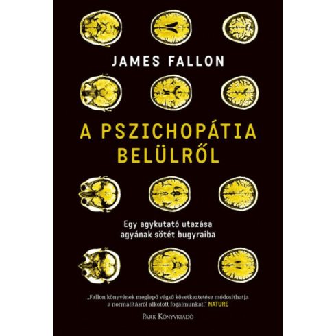 James Fallon: A pszichopátia belülről - Egy agykutató utazása agyának sötét bugyraiba